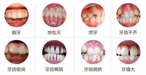 活动假牙与隐形义齿的区别,隐形活动假牙的优缺点(图1)